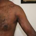 Work Injury Compensation 2